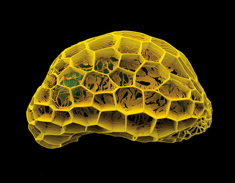 микроскопическое фото
