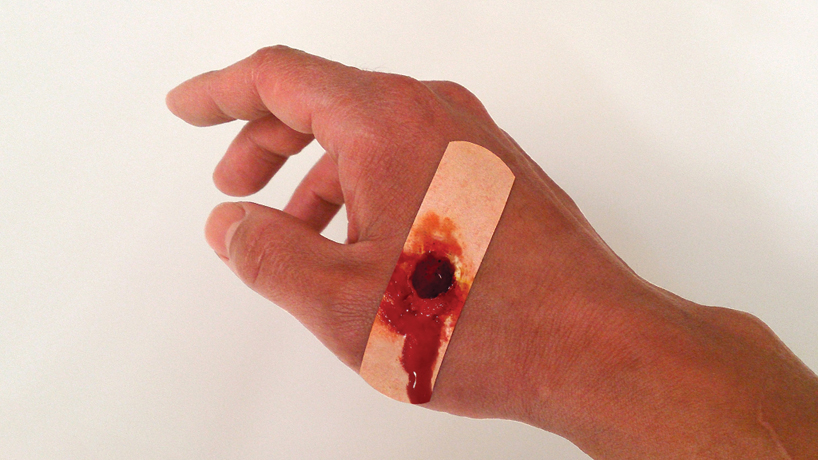 boo-boos, the bandaid that hurts to look at, by sherwood forlee