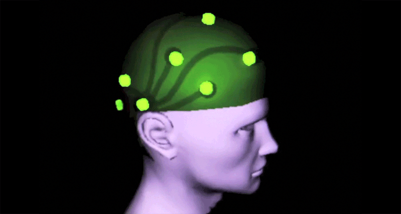 original-ideal-scott-chasserot-brain-scan-designboom-01