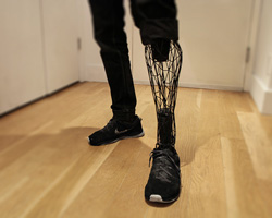 3D printed exo-prosthetic leg becomes a customizable body part