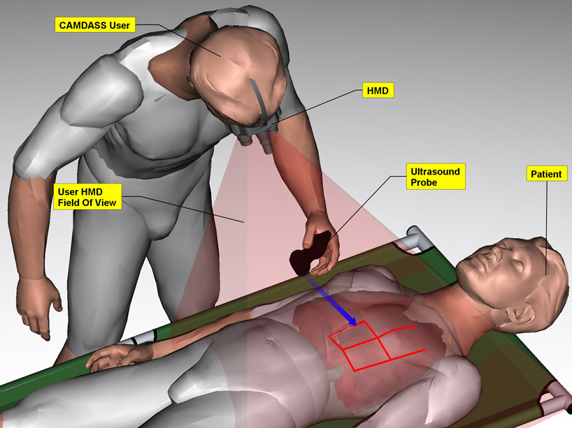 augmented reality surgery with CAMDASS