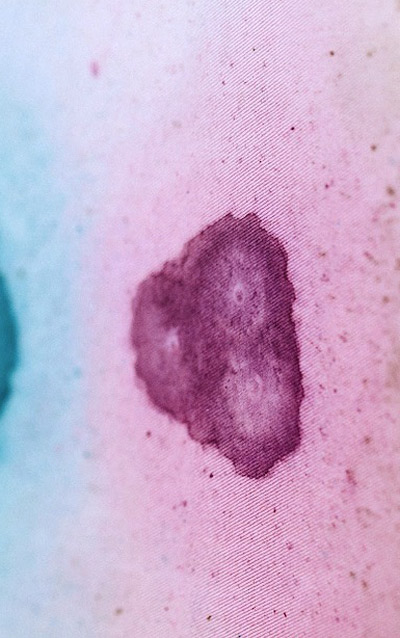 leslie a. grossman: circumstances