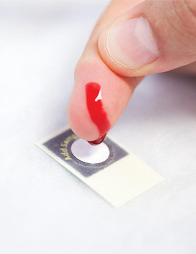 stamp sized paper blood tests for detecting liver damage
