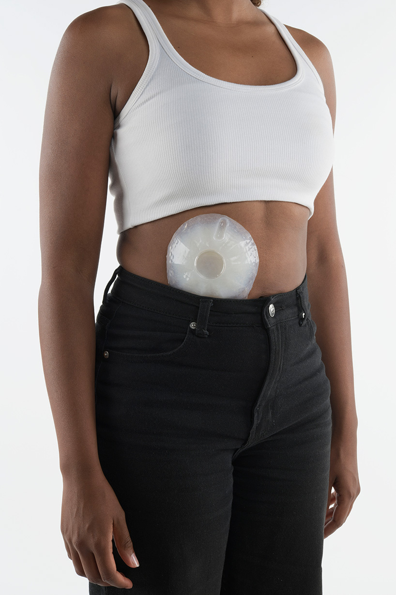 the organ is viewed as a living detox system