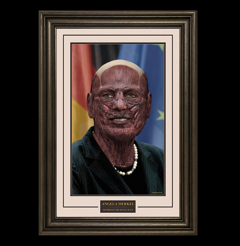 world leaders skin removed