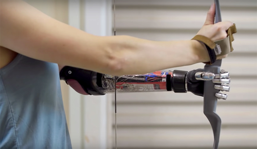 Why people should stop designing prosthetics that look realistic—and s