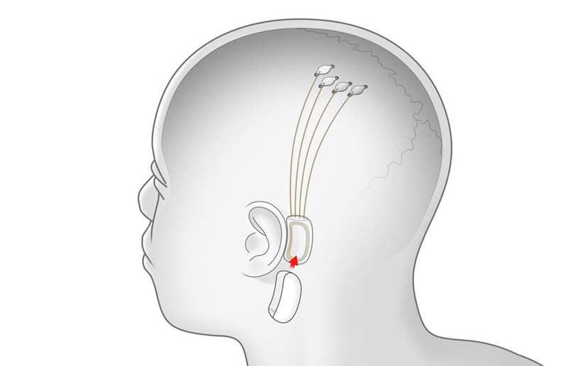 designboom 2020 TECH PREDICTIONS: cyborgs and brainjacking