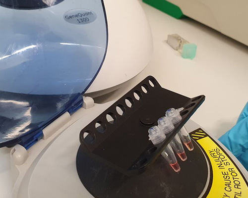 oxford scientists develop 30-minute-result test for coronavirus