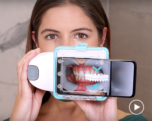 scanbox, the dental scanner that sends images of your teeth to your dentist