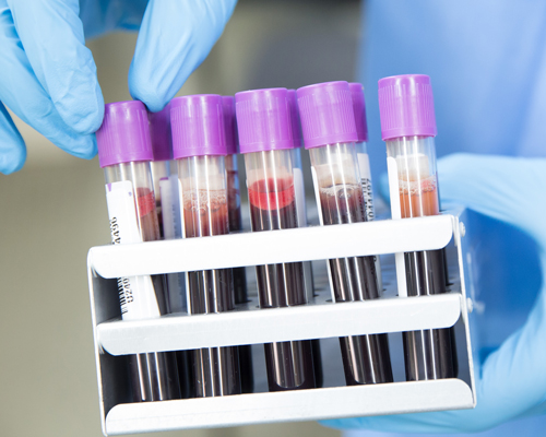 researchers say mass blood tests could help combat the coronavirus pandemic