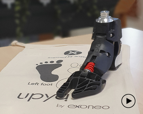 3D-printed upya foot prosthetic is 20 times cheaper than conventional