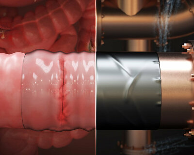 MIT engineers develop surgical ‘duct tape’ for sutures and operations