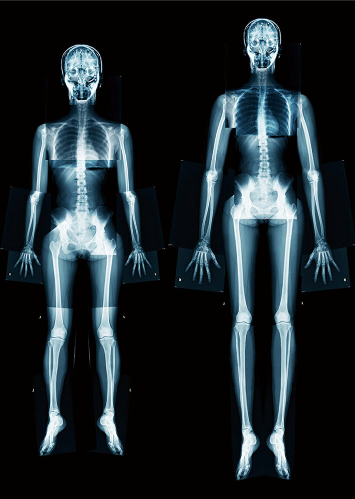 kumi kaguraoka explores beauty standards with her body-reconstructing devices