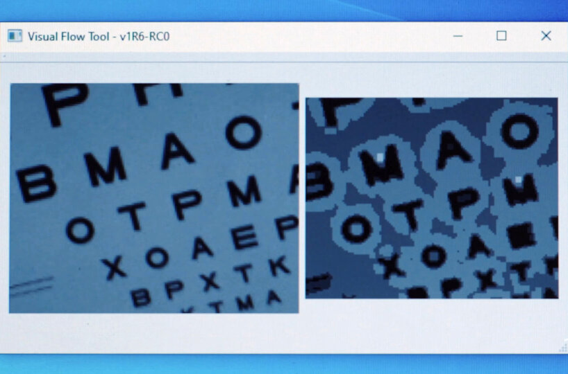 view of what the patients can see (right)